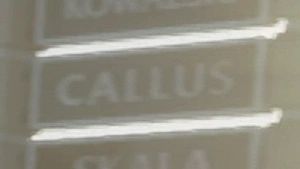 Callus dans GTA 6